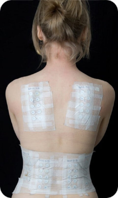 contact dermatitis (5)