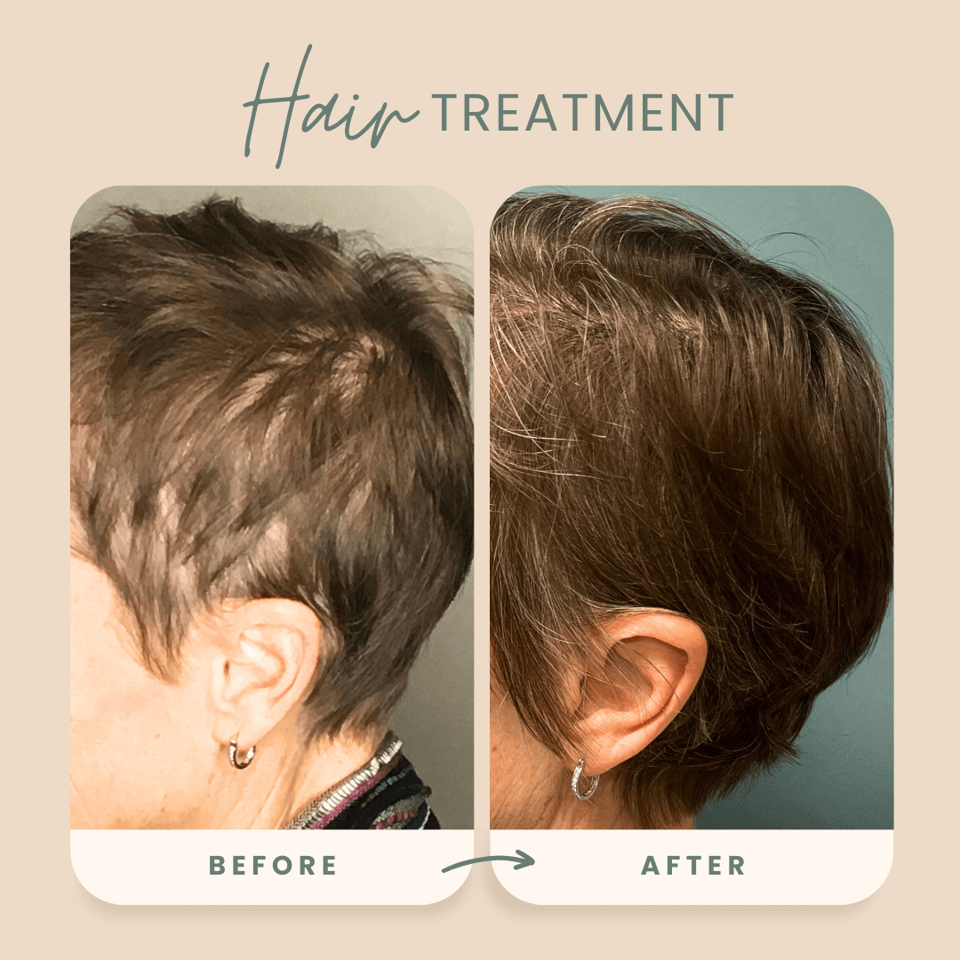 Side-by-side images showcasing a person's hair before and after the HPIHair Partners treatment, highlighting improved smoothness and volume.