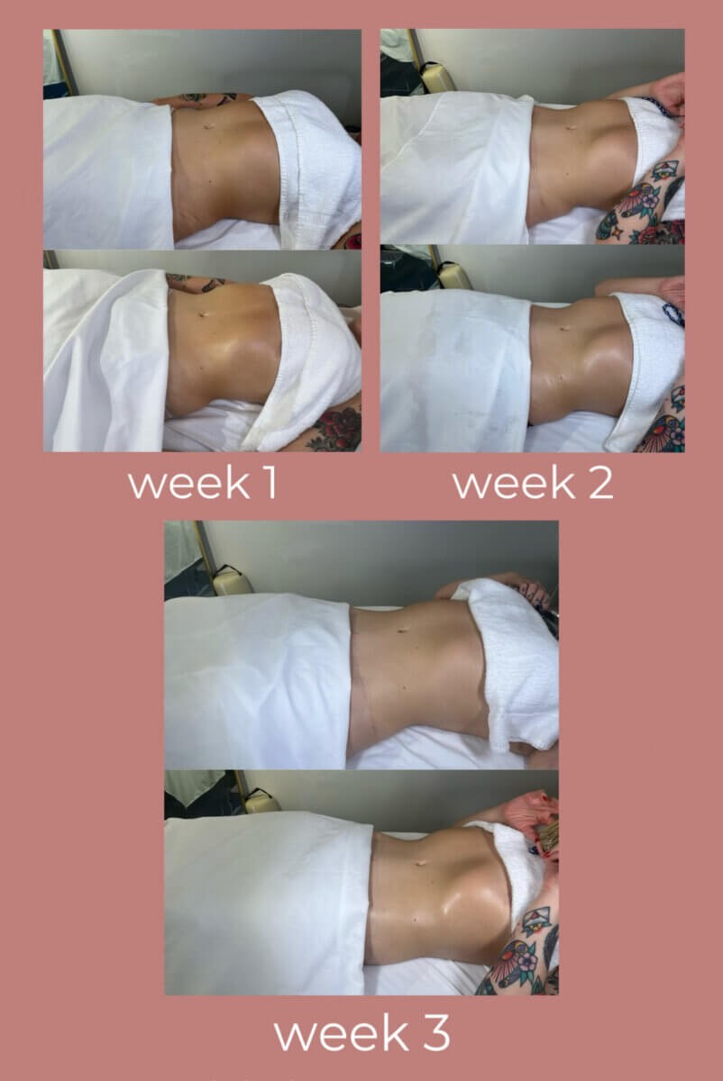 Three sets of side-view photos show a person’s midsection covered in a towel, labeled week 1, week 2, and week 3, to document visible changes over time after regular detox massage sessions.